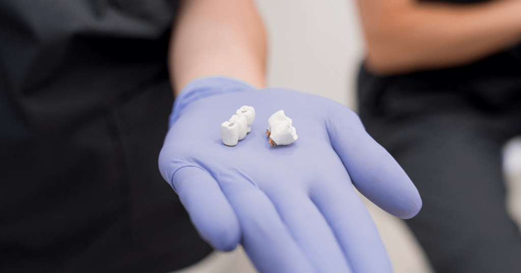 Implantes dentales precio