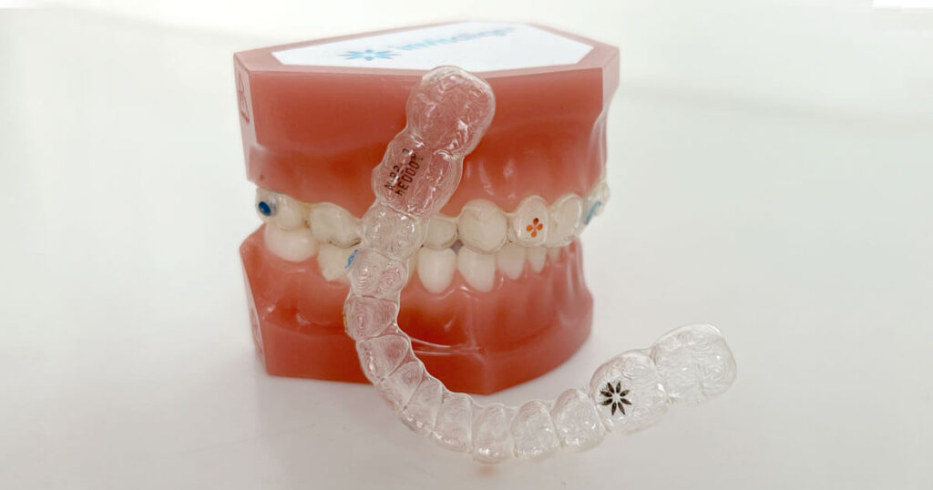 invisalign para niños