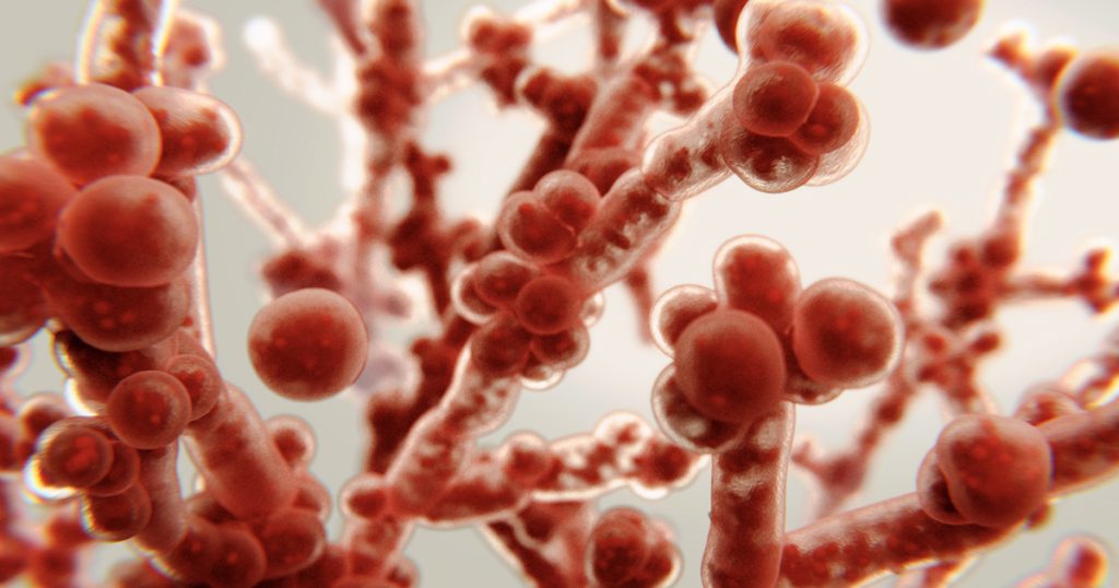 Candidiasis oral