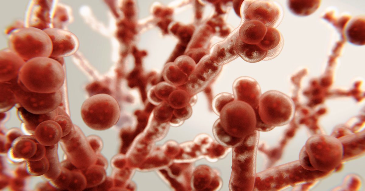 Candidiasis oral