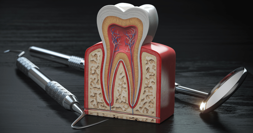 El tratamiento periodontal