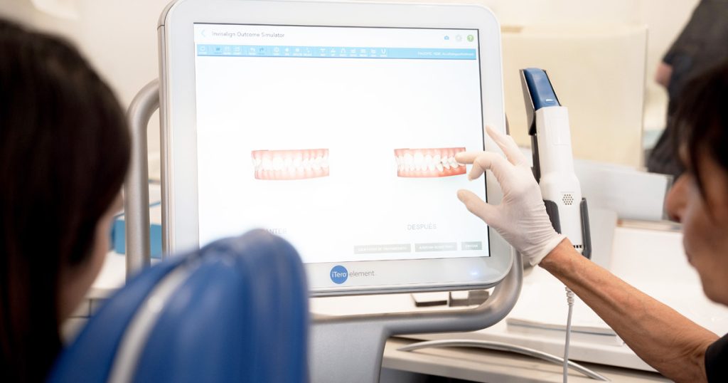 Opiniones invisalign