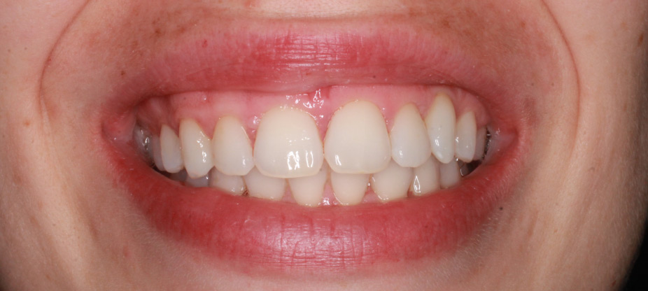Caso de éxito canino incluido