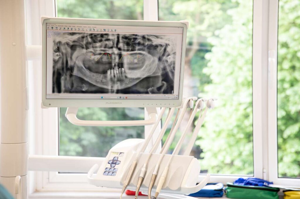 Radiografía pérdida de hueso dental