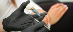 ¿Cuánto dura un implante dental?